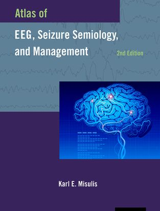Atlas of EEG, Seizure Semiology, and Management, 2nd ed