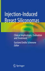 Injection-Induced Breast Siliconomas