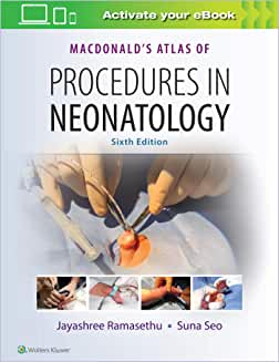 MacDonald's Atlas of Procedures in Neonatology Sixth edition