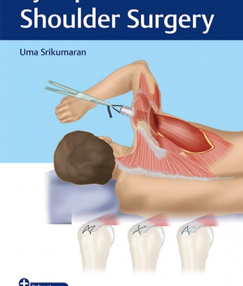 Synopsis of Shoulder Surgery