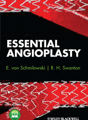 Essential Angioplasty