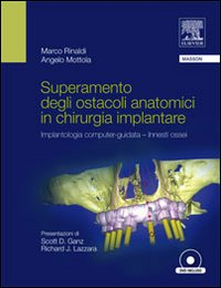 Superamento degli Ostacoli Anatomici in Chiurgia Implantare