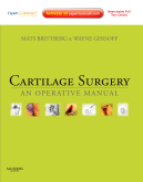 Cartilage Surgery