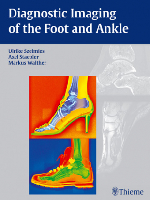 Diagnostic Imaging of the Foot and Ankle 