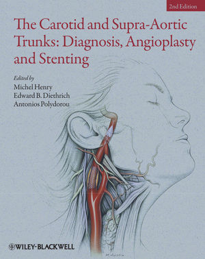 The Carotid and Supra-Aortic Trunks: Diagnosis, Angioplasty and Stenting, 2nd Edition
