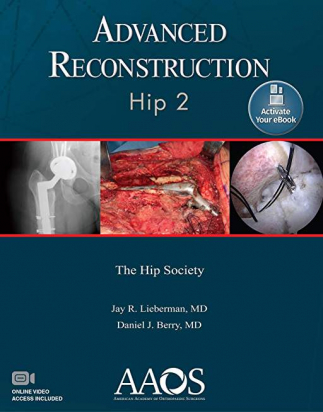 Advanced Reconstruction: Hip 2: Print + Ebook with Multimedia Advanced Reconstruction