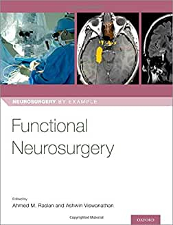 Functional Neurosurgery