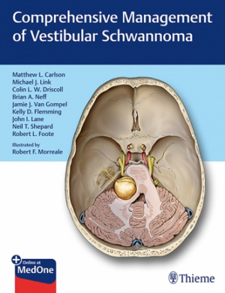 Comprehensive Management of Vestibular Schwannoma