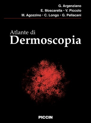 Atlante di Dermoscopia