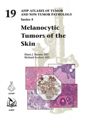 AFIP SERIES 5 N. 19 - Melanocytic Tumors of Skin