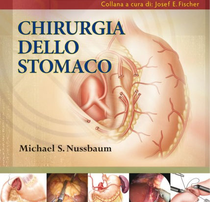 Chirurgia dello stomaco