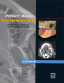 Specialty Imaging: Head &amp; Neck Cancer
