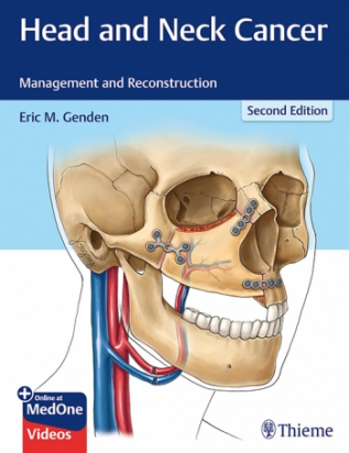 Head and Neck Cancer