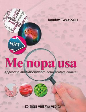 Menopausa