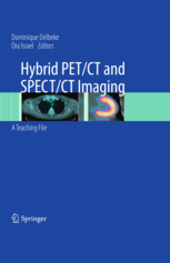 Hybrid PET/CT and SPECT/CT Imaging  -  A Teaching File