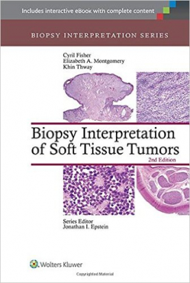 Biopsy Interpretation of Soft Tissue Tumors, 2e