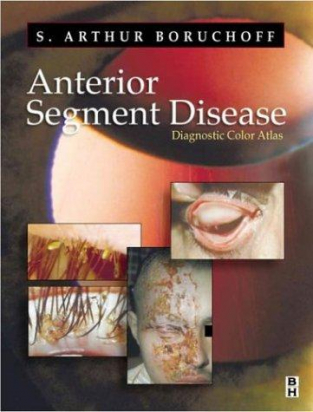 Anterior Segment Disorder: A Diagnostic Color Atlas, 1e 