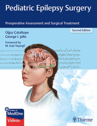 Pediatric Epilepsy Surgery