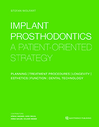 Implant Prosthodontics: A Patient-Oriented Strategy