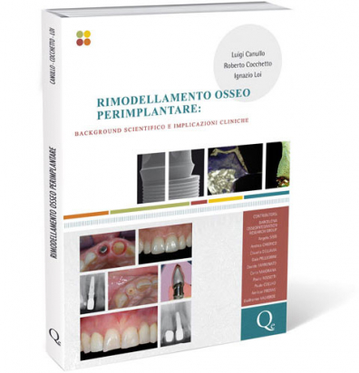 Rimodellamento osseo perimplantare