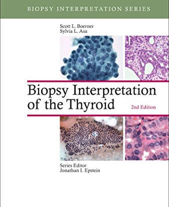 Biopsy Interpretation of the Thyroid, 2e