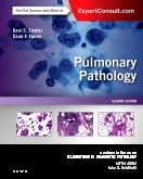 Pulmonary Pathology, 2nd Edition 