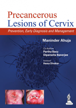Precancerous Lesions of Cervix