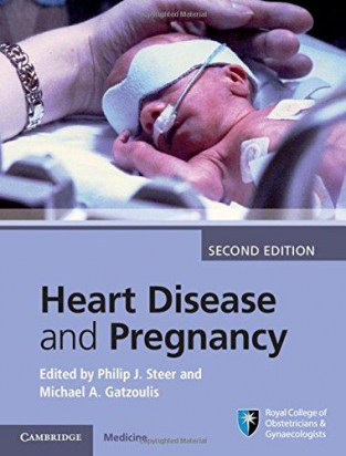 Heart Disease and Pregnancy 2nd ed