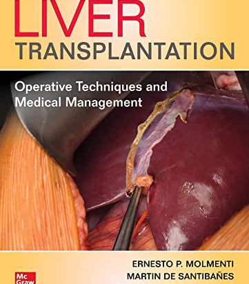  Liver Transplantation: Operative Techniques and Medical Management