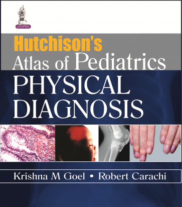 Hutchison's Atlas of Pediatric Physical Diagnosis