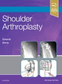 Shoulder Arthroplasty, 2nd Edition
