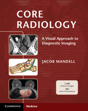 Core Radiology A Visual Approach to Diagnostic Imaging