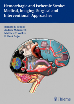 Hemorrhagic and Ischemic Stroke