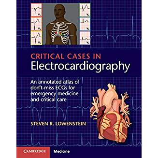 Critical Cases in Electrocardiography