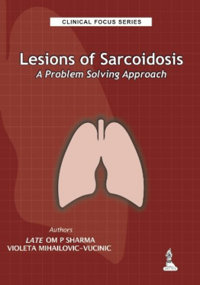 Clinical Focus Series: Lesions of Sarcoidosis