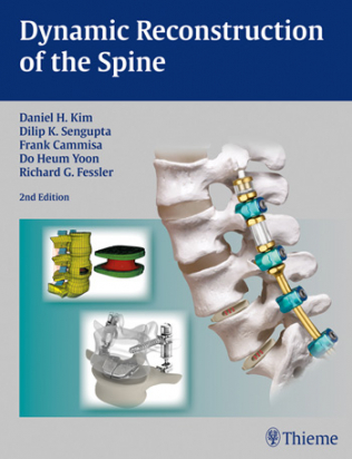 Dynamic Reconstruction of the Spine 2nd ed