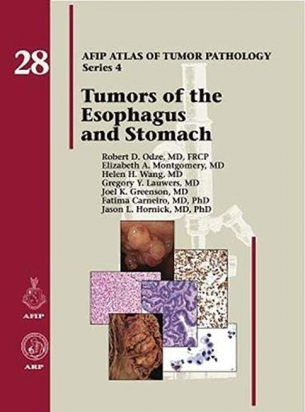 AFIP 4 Fasc. 28 Tumors of the Esophagus and Stomach