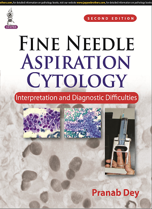 Fine Needle Aspiration Cytology: Interpretation and Diagnostic Difficulties