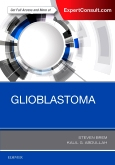 Glioblastoma 