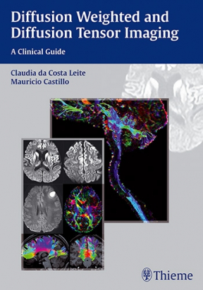 Diffusion Weighted and Diffusion Tensor Imaging: A Clinical Guide