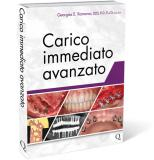 Carico immediato avanzato