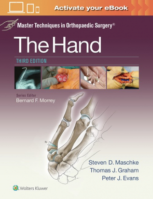 Master Techniques in Orthopaedic Surgery: The Hand 3e