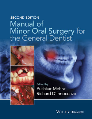 Manual of Minor Oral Surgery for the General Dentist, 2nd Edition