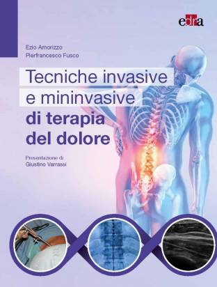 Tecniche Invasive e Mininvasive di Terapia del dolore