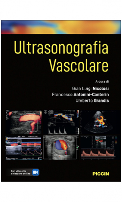 Ultrasonografia Vascolare