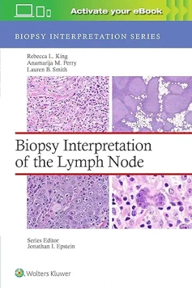 Biopsy Interpretation of the Lymph Nodes, First edition