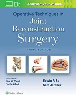 Operative Techniques in Joint Reconstruction Surgery Third edition