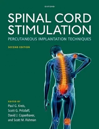 Spinal Cord Stimulation, Second Edition
