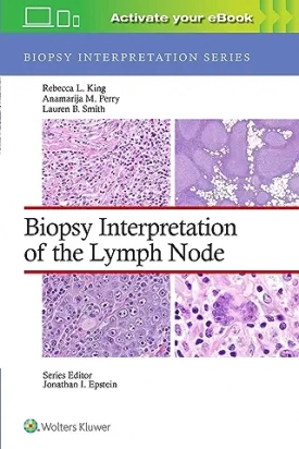Biopsy Interpretation of the Lymph Nodes, First edition