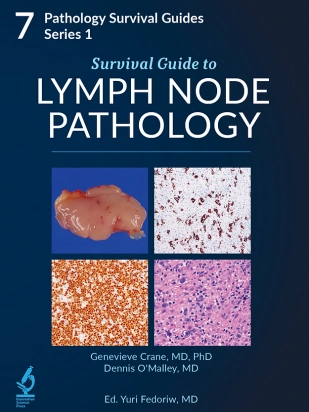 Survival Guide to Lymph Node Pathology
